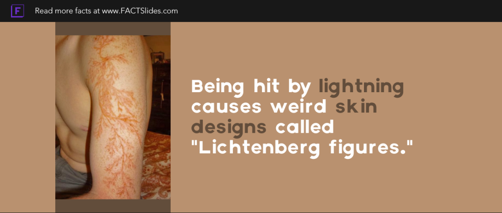 ok — logija: Lichtenberg figure burned into the skin...